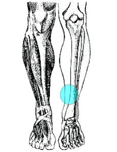 shin splints osteopatia medio-tibiale