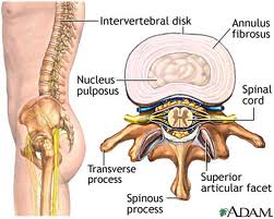 disco intervertebrale nucleo