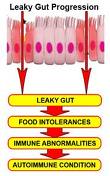 candida Leaky Gut Syndrome