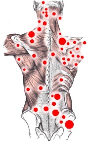 fibromialgia osteopatia