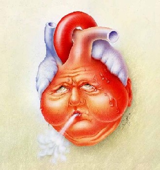 insufficienza cardiaca