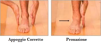 osteopatia fascite plantare piede