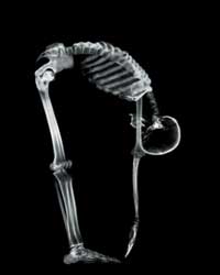 osteopatia postura osteoporosi