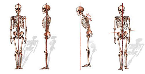osteopatia postura scorretta