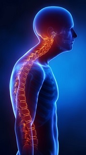 Kyphotic spine lateral view in x-ray