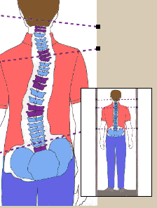 postura atlante osteopatia 2