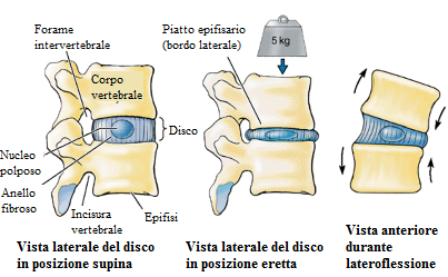 disco intervertebrale